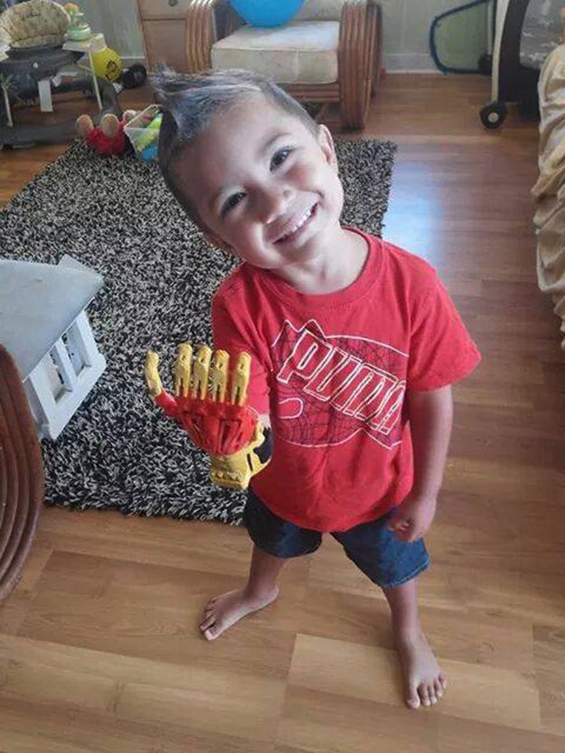 Young Boy Born Without Fingers Gets Awesome New Iron Man Hand