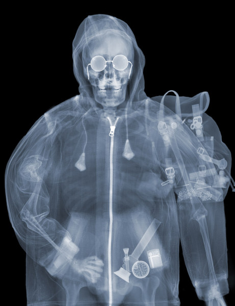 This Guy Exposed Himself To X Ray Radiation For 20 Years In The Name Of Art